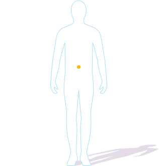 Hereditary Angioedema (HAE) attack locations