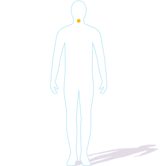 Hereditary Angioedema (HAE) attack locations