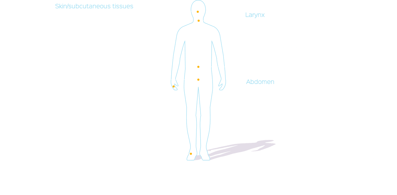 Hereditary Angioedema (HAE) Attack Locations